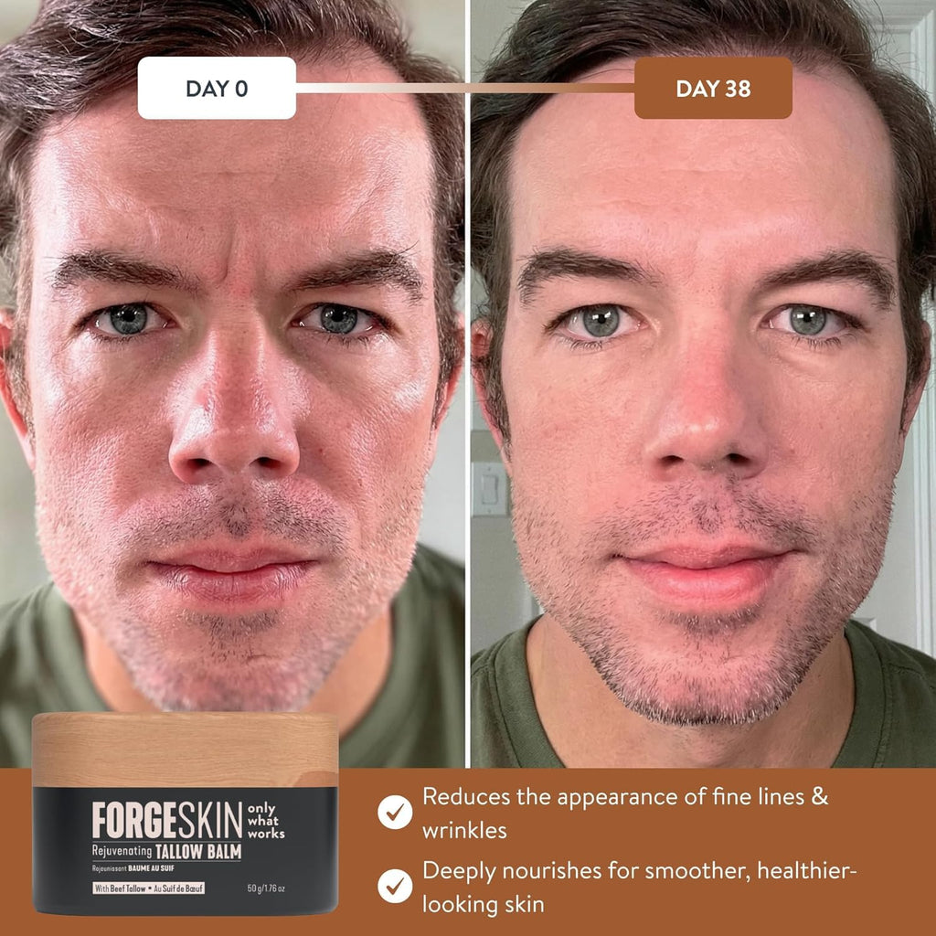 FORGE SKIN Wrinkle Defense Beef Tallow Balm for Men, Face Moisturizer, Anti-Aging Skin Cream, Natural Facial Care Lotion with Essential Oils, 50 ml