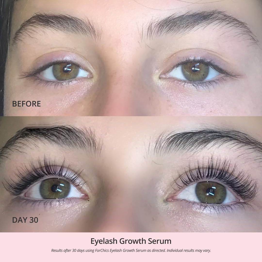 ForChics Eyelash Growth Serum - Prostaglandin-Free Lash Enhancing for Longer, Thicker Lashes and Brows- Natural Formula, Visible Results in 2 Weeks Vegan, Hormone-Free, 0.10 Fl. Oz, 3ml
