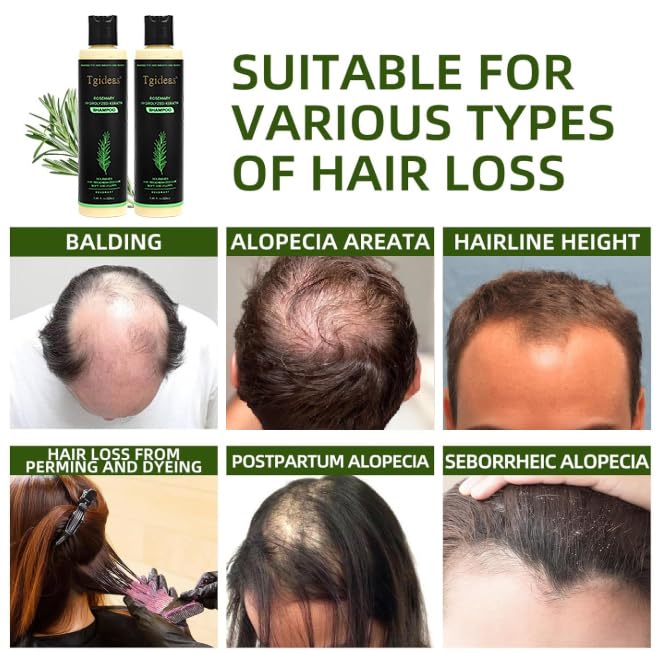 Tgideas Organic Shampoo for Hair Growth Rosemary and , Natural for Strengthening and Thickening with Hydrolyzed Keratin for Fine and Loss, for Women Men, 7.4ml